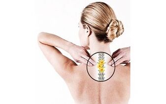 cervikální osteochondróza u ženy