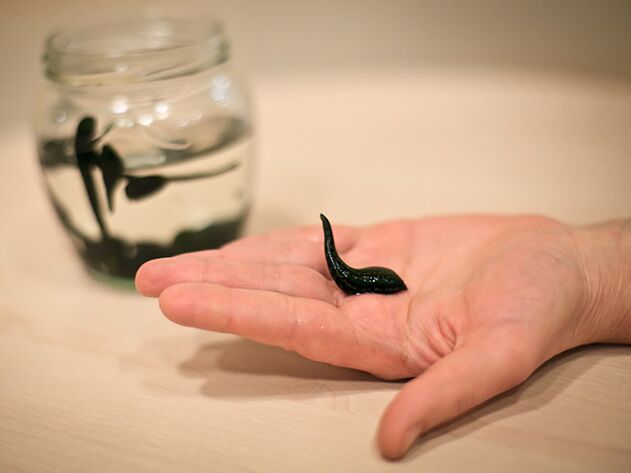 aplikace pro léčbu artrózy kolenního kloubu